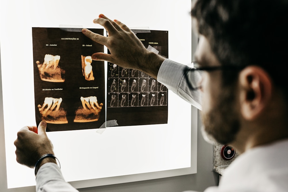 Dentist reviewing 3D dental imaging